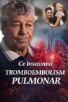 Mircea Lucescu, diagnostic grav înainte de deces: ce au descoperit medicii la investigația CT