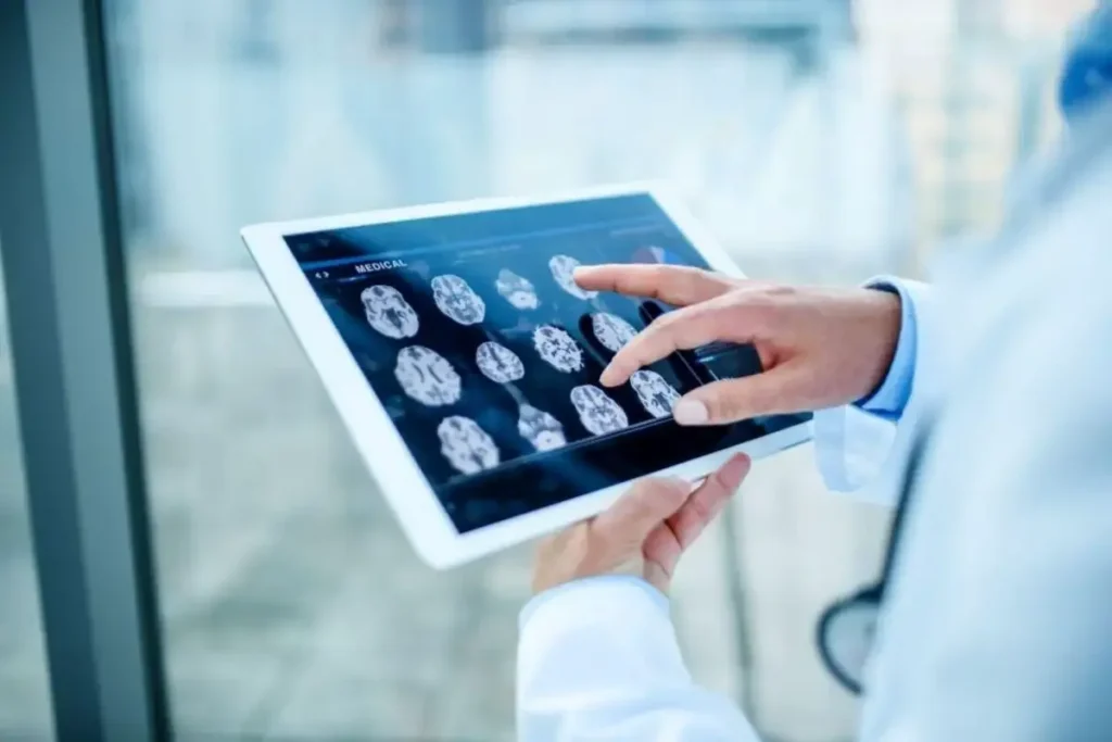 Diagnostic analizat cu AI